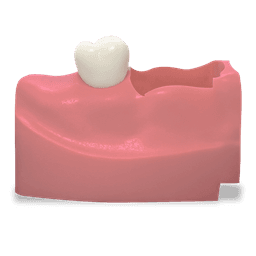 Product thumbnail 1